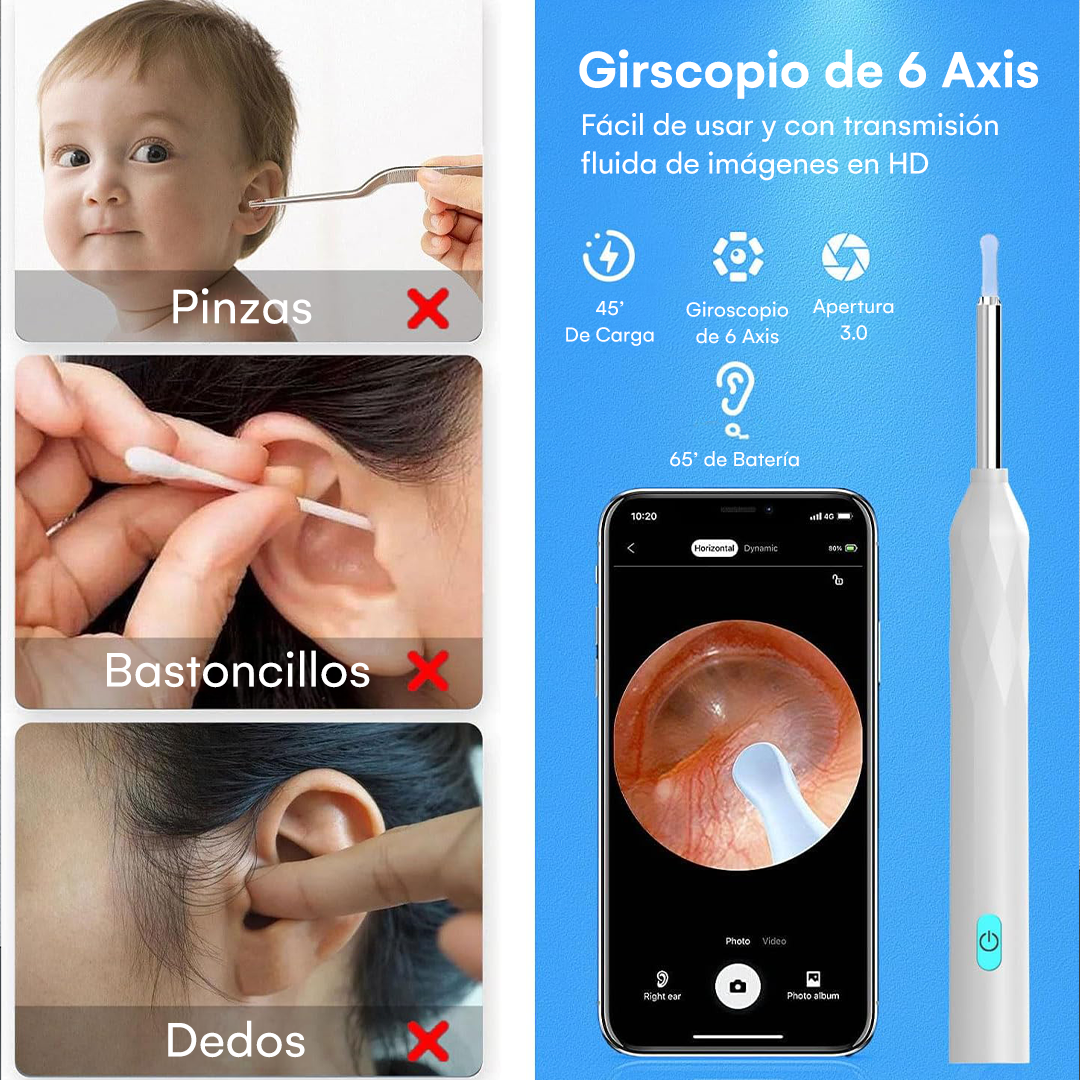 Limpia Oídos Inalámbrico con Cámara 1296P